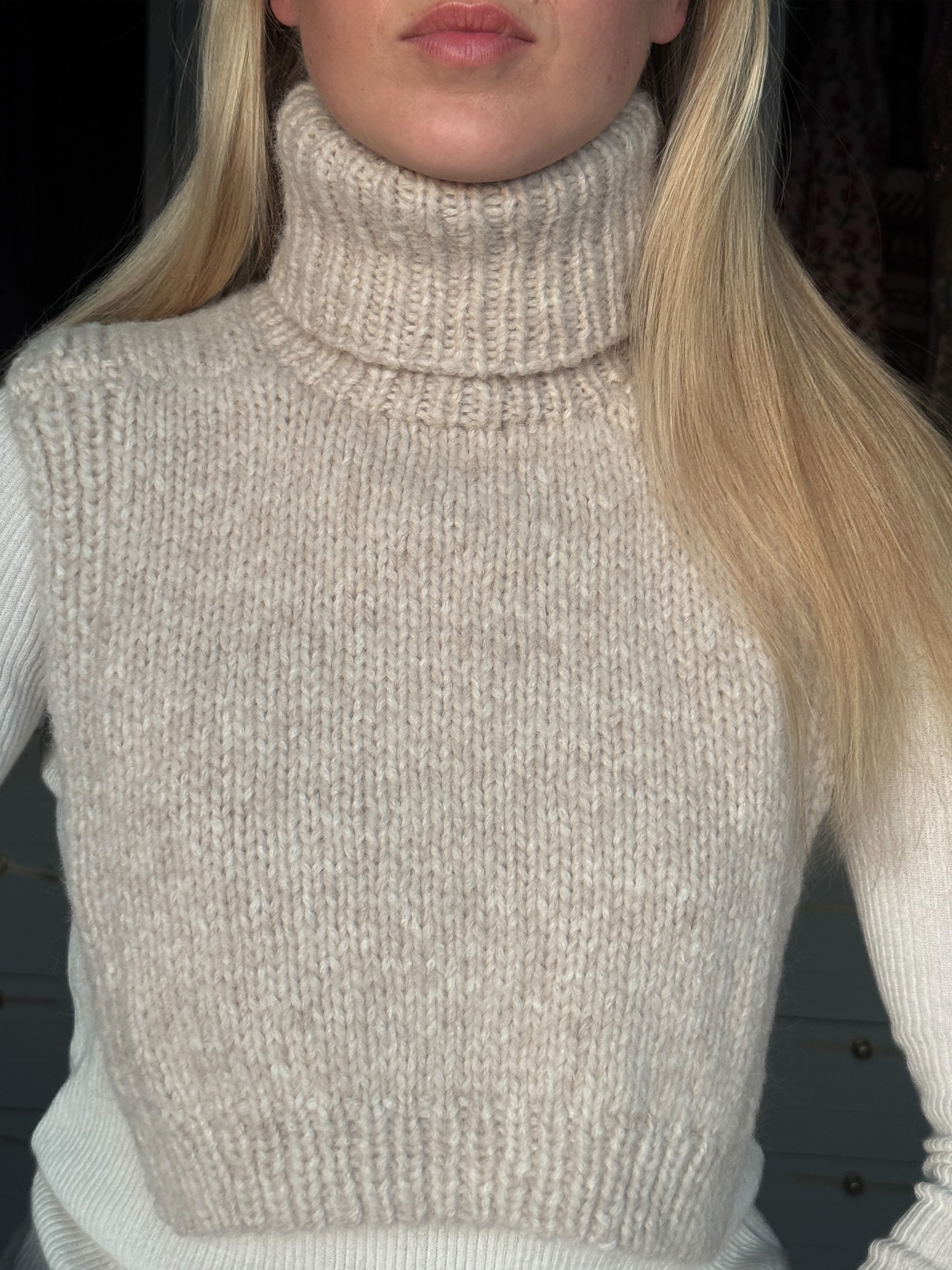 IR 05-06b Frost hals (Pus)